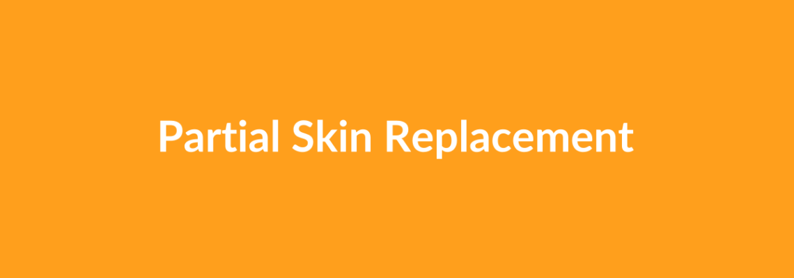 Complete Guide to Partial Skin Replacement | Top Surgeons & Options
