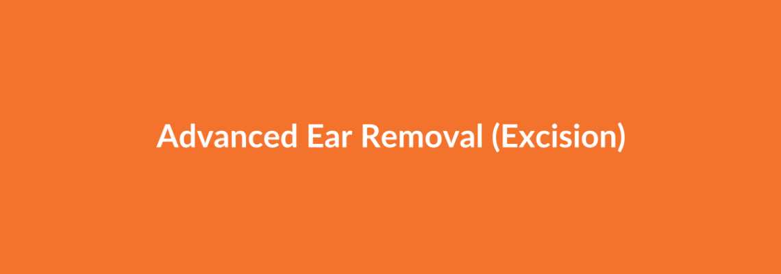 Complete Guide to Advanced Ear Removal (Excision) | Top Surgeons & Options