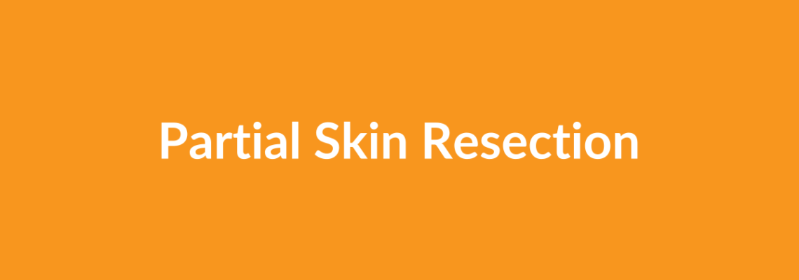 Complete Guide to Partial Skin Resection | Top Surgeons & Options