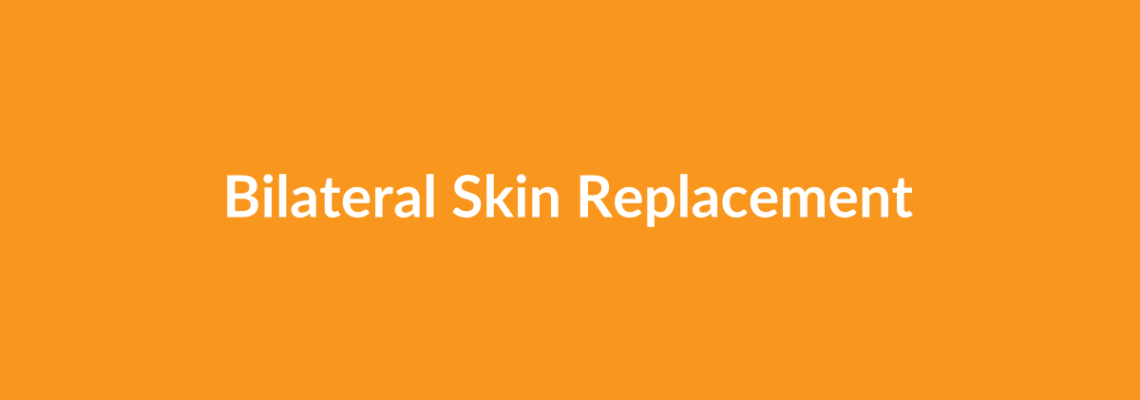 Complete Guide to Bilateral Skin Replacement | Top Surgeons & Options