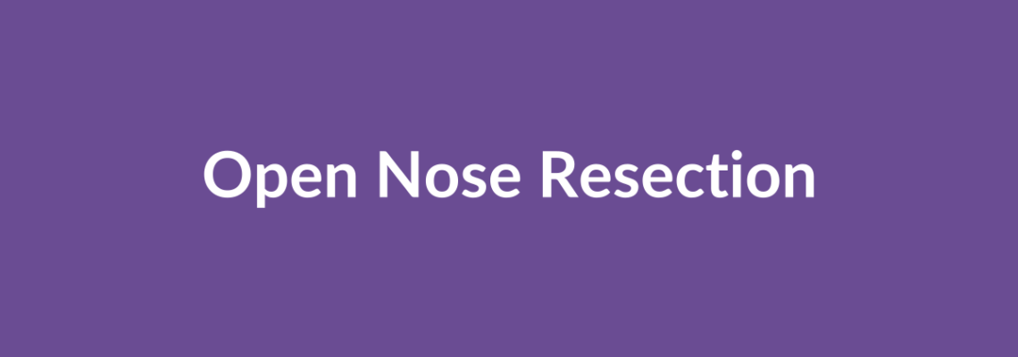 Complete Guide to Open Nose Resection | Top Surgeons & Options