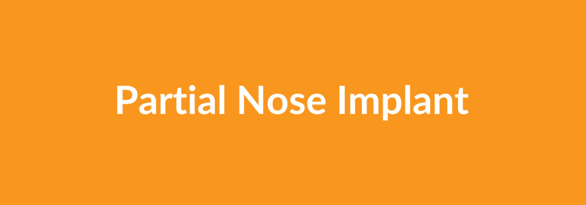 Complete Guide to Partial Nose Implant | Top Surgeons & Options